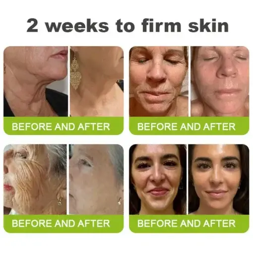 Botin Vita-A Retinol Shot Wrinkle-Lift Tightening cream – Last Day Promotion 70 OFF - Image 2
