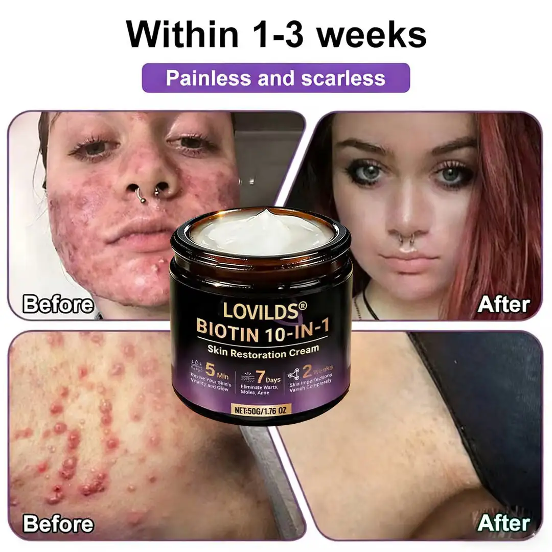 Biotin 10-in-1 Skin Restoration Cream - Image 4