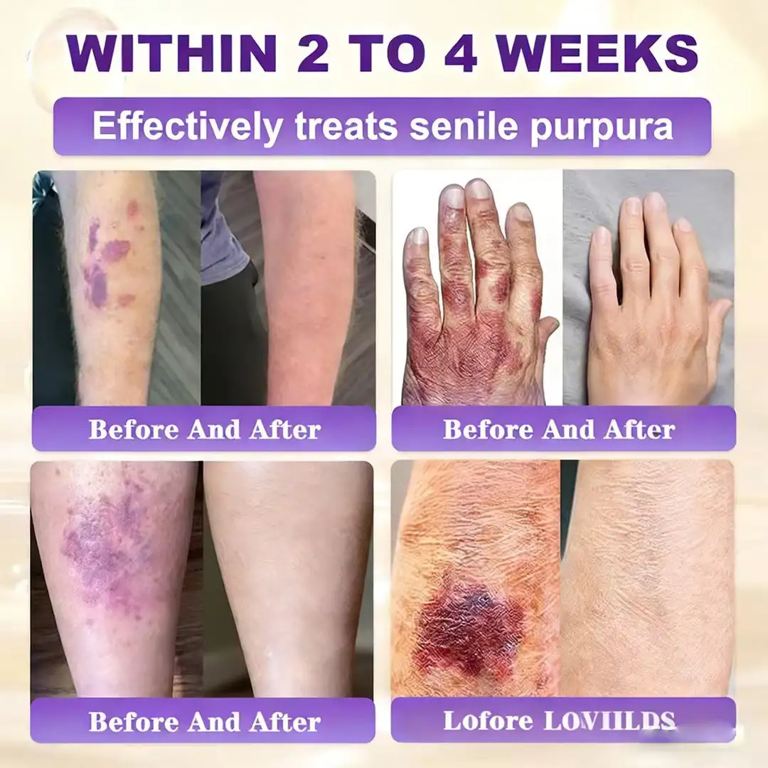 Biotin 10-in-1 Skin Restoration Cream - Image 6