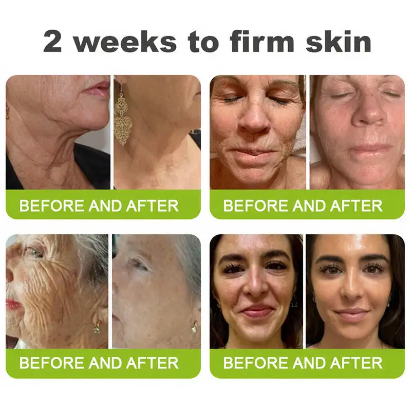 Skin Tightening & Vita-A Retinol Retinol shot Anti-Wrinkle Firming Tightening cream - Last Day Promotion 50% OFF - Image 7
