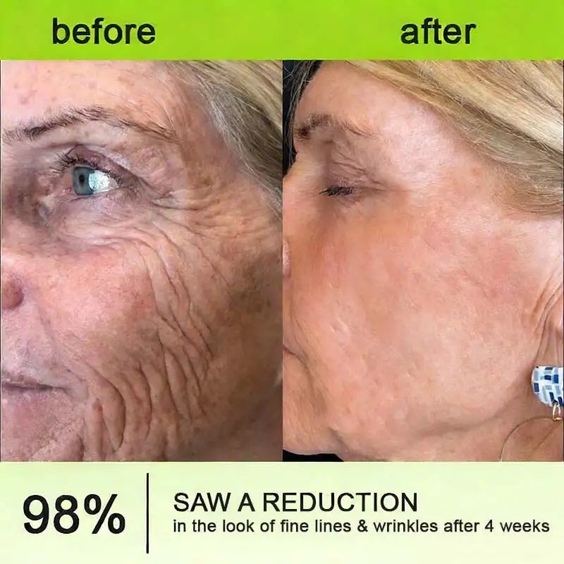 moringa & Vita-A Retinol Shot Wrinkle-Lift Tightening cream - Last Day Promotion 70% OFF - Image 12