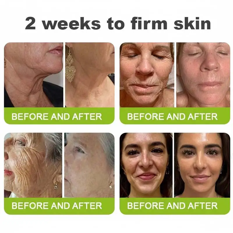 🧠👨⚕️Made and shipped from the USA moringa & Vita-A Retinol Shot Wrinkle-Lift Tightening cream - Last Day Promotion 50% OFF - Image 7