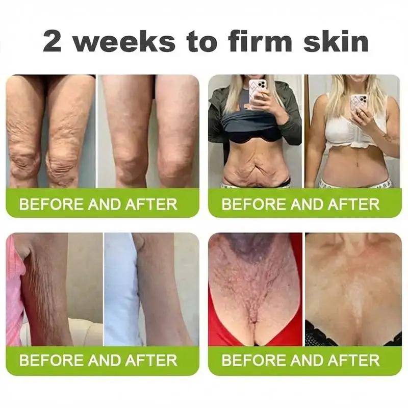 🧠👨⚕️Made and shipped from the USA moringa & Vita-A Retinol Shot Wrinkle-Lift Tightening cream - Last Day Promotion 50% OFF - Image 8