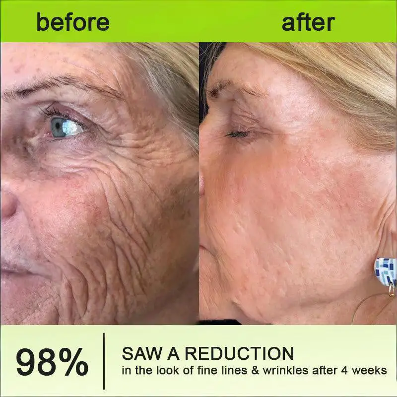 🧠👨⚕️Made and shipped from the USA Botin & Vita-A Retinol Shot Wrinkle-Lift Tightening cream - Last Day Promotion 50% OFF - Image 3