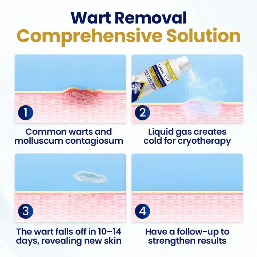 Skin Tag Renewal Spray- Reducing nutrient supply to damaged tissue and accelerating its natural shedding process - Image 4