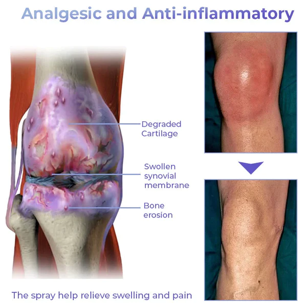 Pro PainRelief Restorative Joint Spray - Image 6