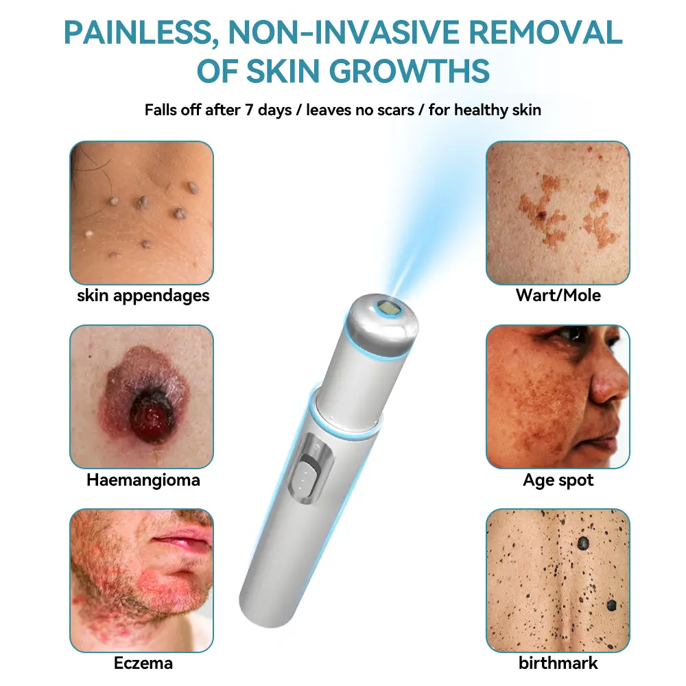 Medical-Grade Laser Pen - Image 4