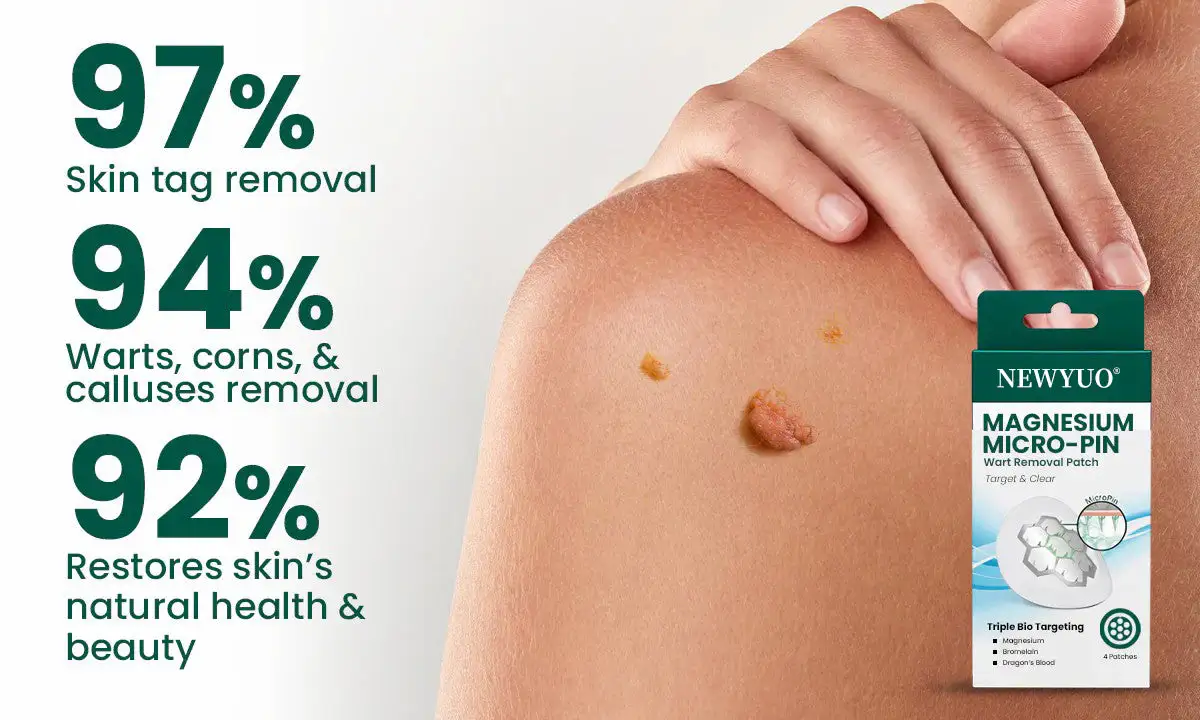 Magnesium Micro-pin Wart Removal Patch - Image 3