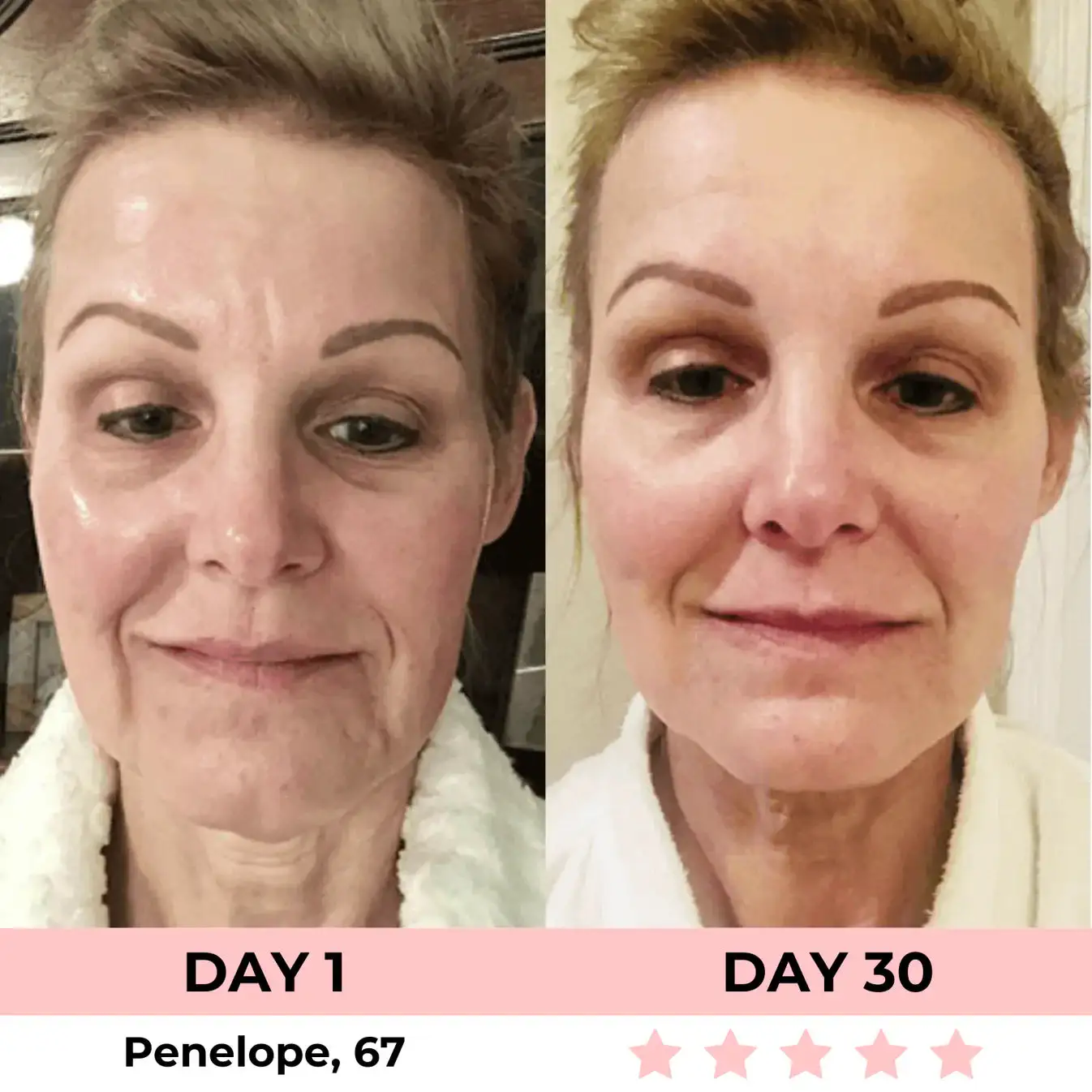 QIAWI 7-in-1 LED Facial Sculptor - Image 7