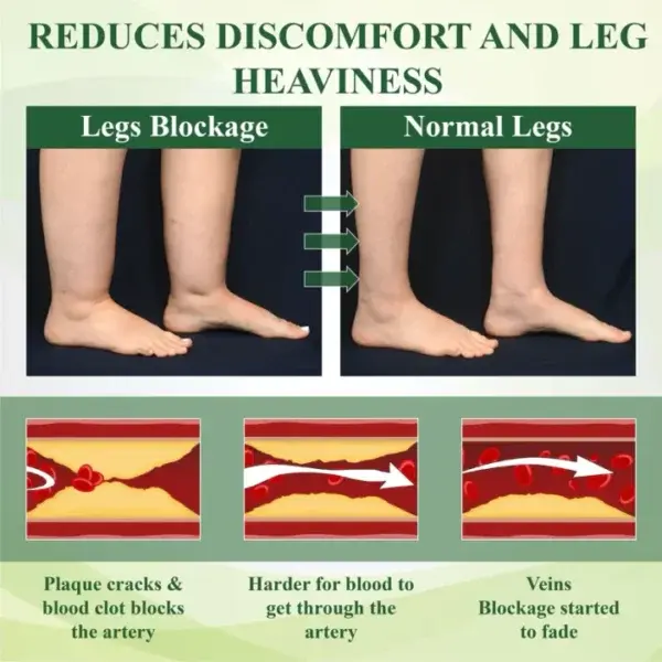 Leg Therapy Edema Cream - Image 8