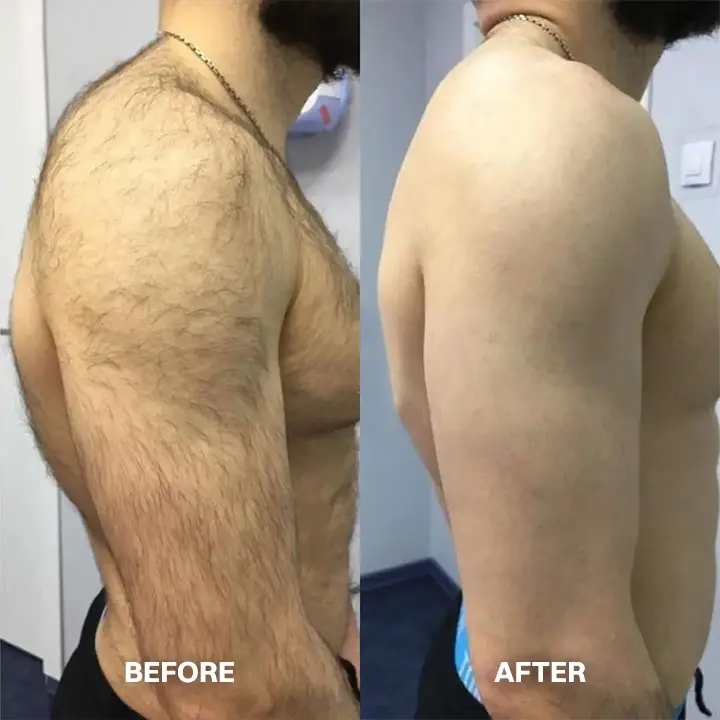 Hair Removal Cream for All Women & Men - Image 10