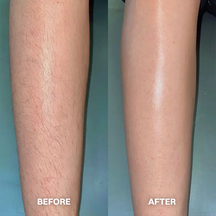 Hair Removal Cream for All Women & Men - Image 11