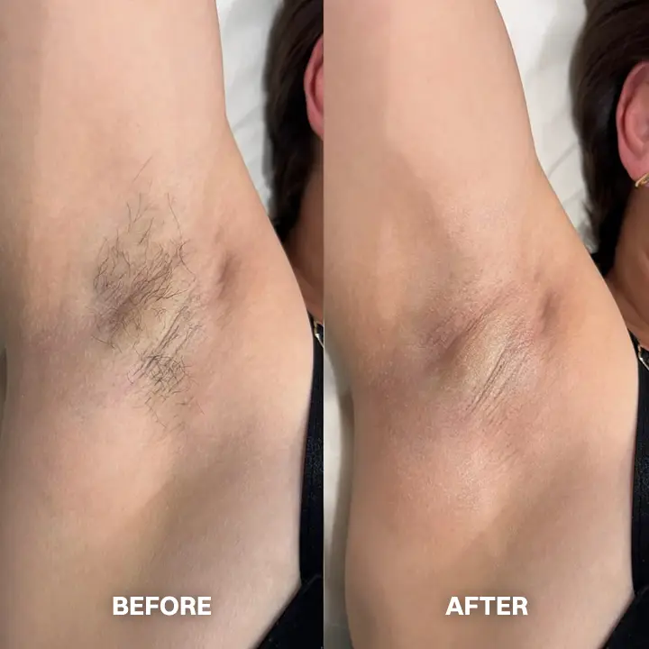 Hair Removal Cream for All Women & Men - Image 12
