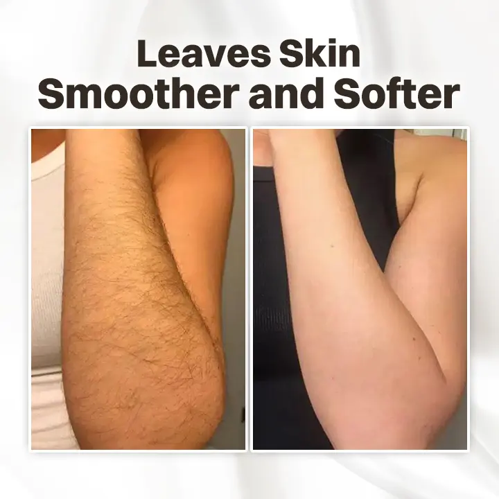 Hair Removal Cream for All Women & Men - Image 3