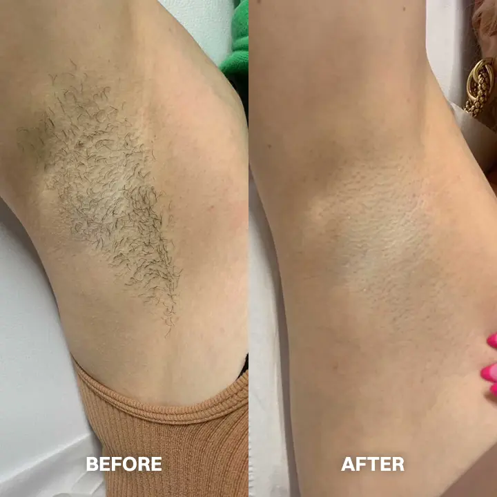 Hair Removal Cream for All Women & Men - Image 8