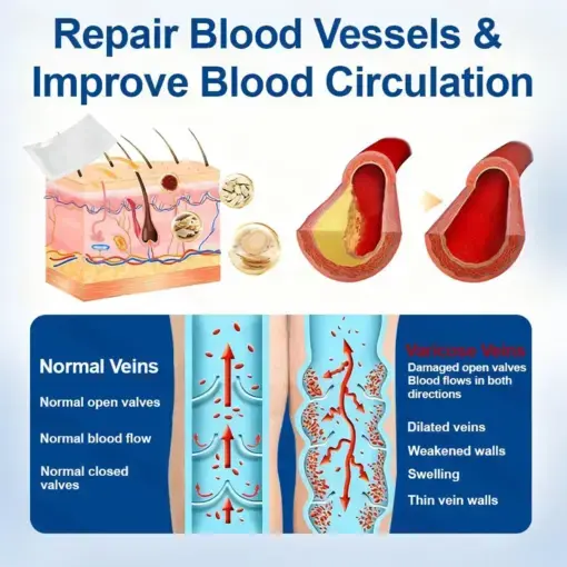 VeinEase Microneedle Care PatchInstant Relief, Long-Term Results - Image 8