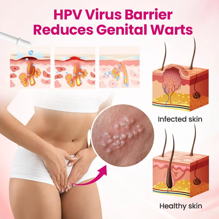 IntiDefend Anti-HPV Interferon Gel - Image 12