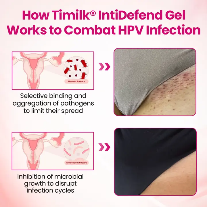 IntiDefend Anti-HPV Interferon Gel - Image 9