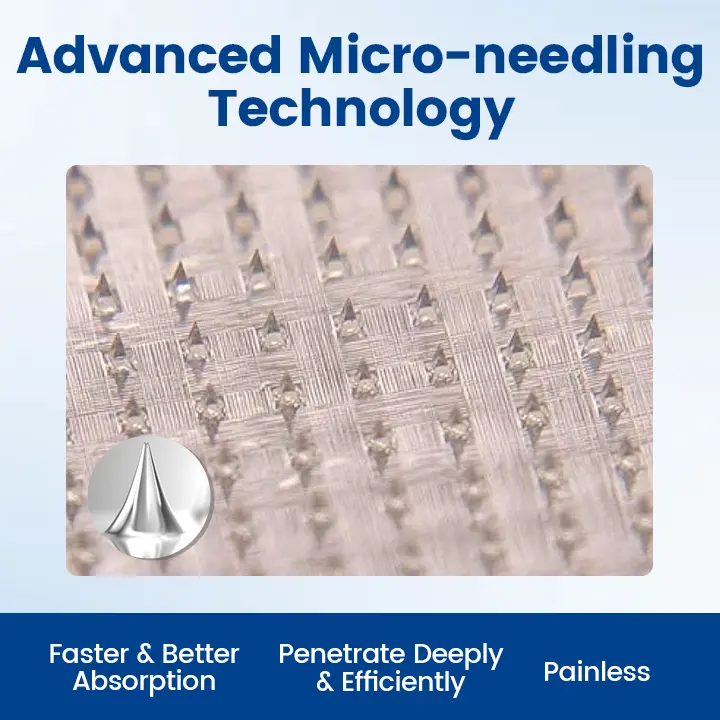 Vein Ease Microneedle Therapy Patch - Fast ⚡Effective 💪 and Non-Invasive 🚫 Treatment for Varicose Veins & Leg Swelling 👣 - Image 2