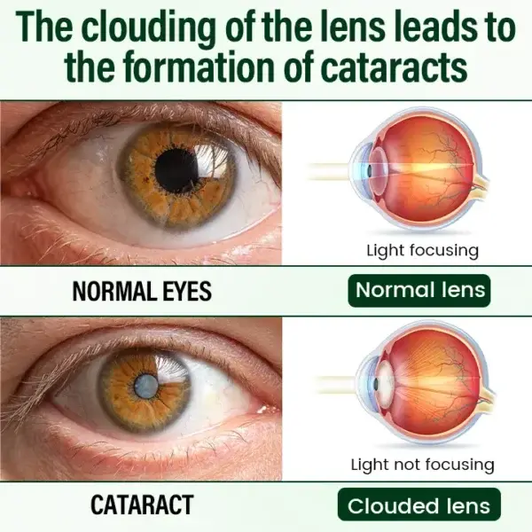 VisionClear Nano Eye Drops - Image 5