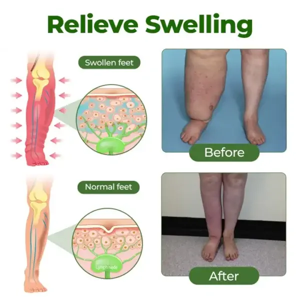 Professional Leg Circulation Cream - Image 4