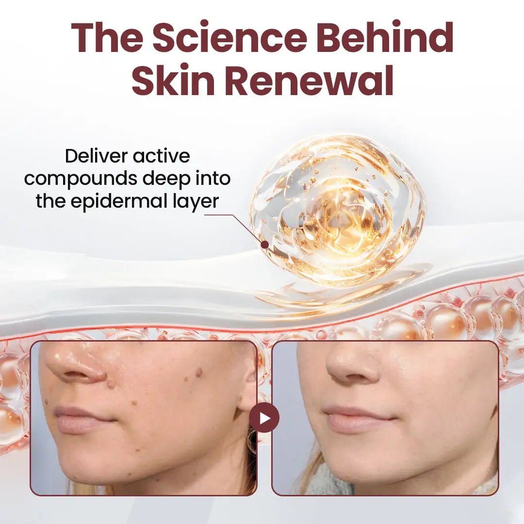 KeraErase Dual-Action Renewal Cream | Smooth & Renew Skin Effortlessly - Image 4