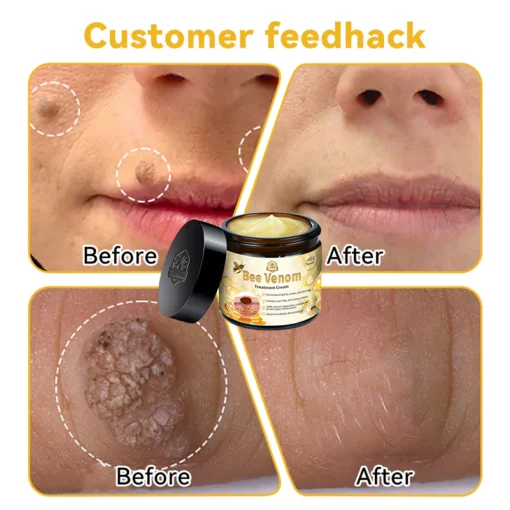 Aotearoa Bee Venom Skin Treatment Cream - Image 6