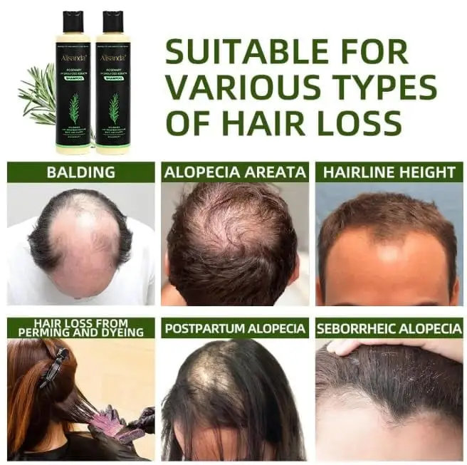 🔥**¡ÚLTIMO DÍA: 50% DE DESCUENTO!** - 🎅Champú orgánico de romero para el crecimiento del cabello - Image 2