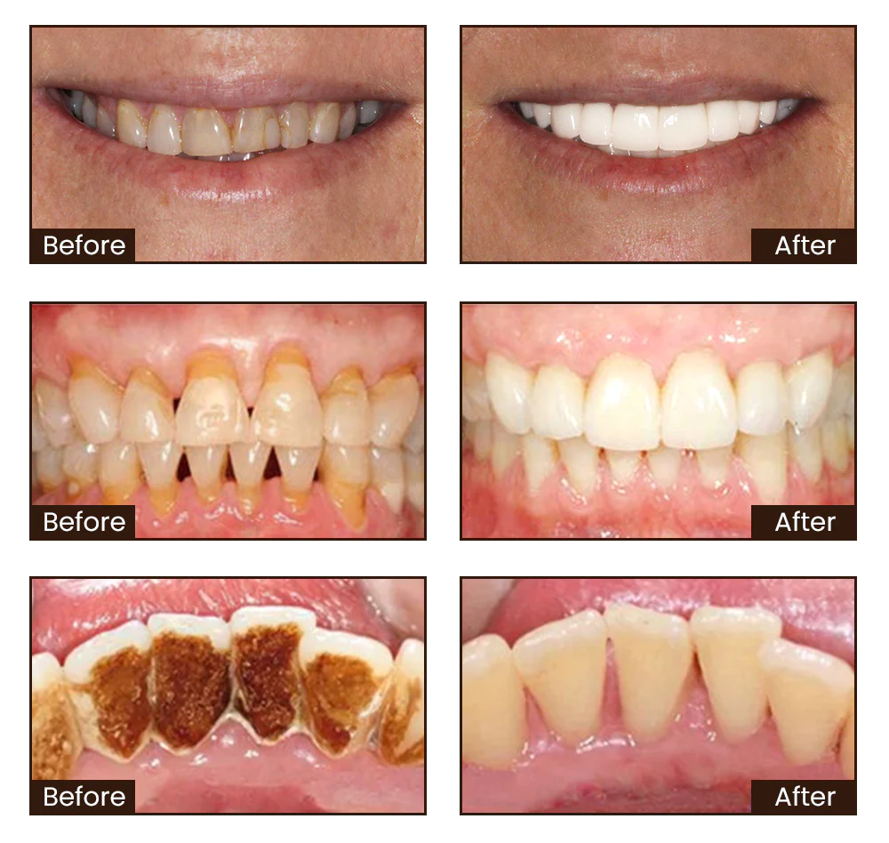 Niacinamide Whitening Toothpaste - Image 4