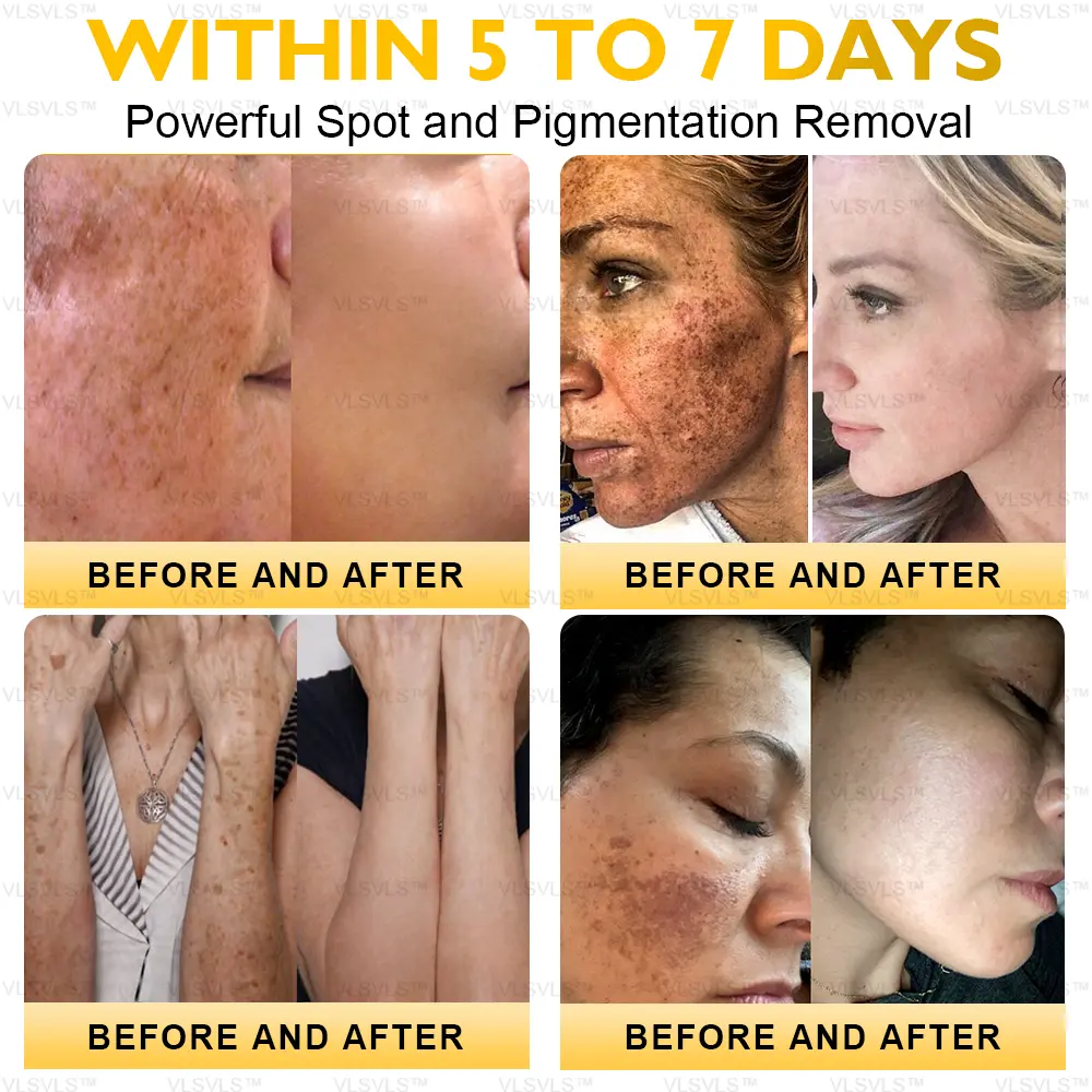 Ultimate All-Body Skin Restoration Cream - Image 5