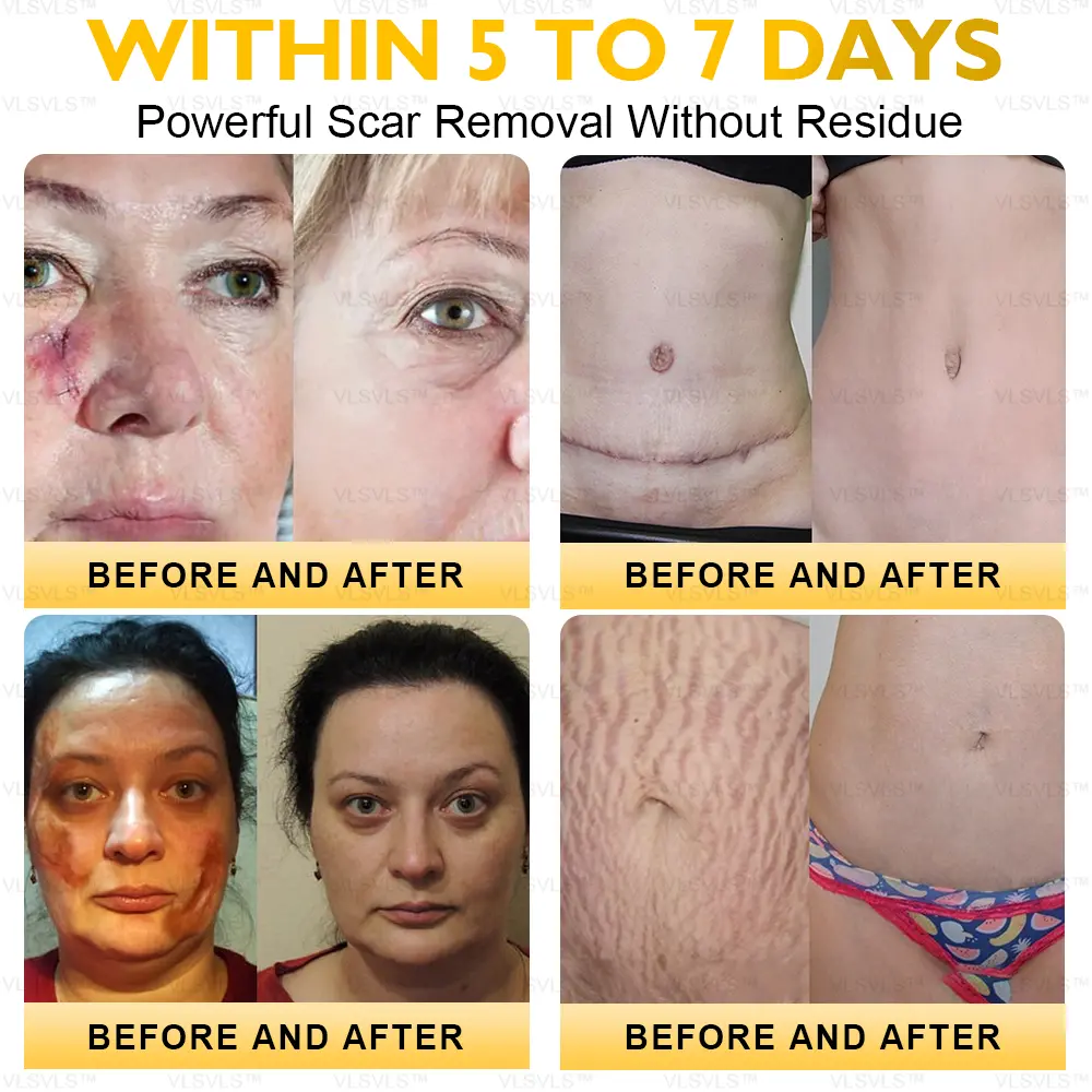 Ultimate All-Body Skin Restoration Cream - Image 7