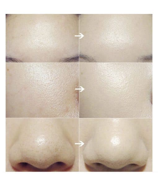 Facial Cleansing Brush - Image 4