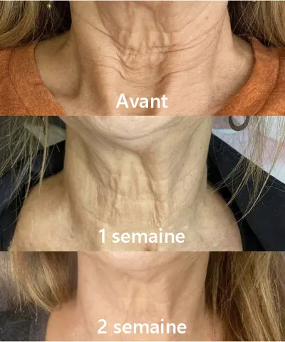𝐂𝐫è𝐦𝐞 𝐑𝐚𝐟𝐟𝐞𝐫𝐦𝐢𝐬𝐬𝐚𝐧𝐭𝐞 𝐚𝐮 𝐂𝐨𝐥𝐥𝐚𝐠è𝐧𝐞 𝐝𝐞 𝐋𝐮𝐱𝐞 - Image 31