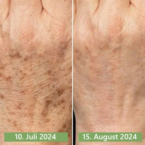 𝐂𝐫è𝐦𝐞 𝐑𝐚𝐟𝐟𝐞𝐫𝐦𝐢𝐬𝐬𝐚𝐧𝐭𝐞 𝐚𝐮 𝐂𝐨𝐥𝐥𝐚𝐠è𝐧𝐞 𝐝𝐞 𝐋𝐮𝐱𝐞 - Image 32