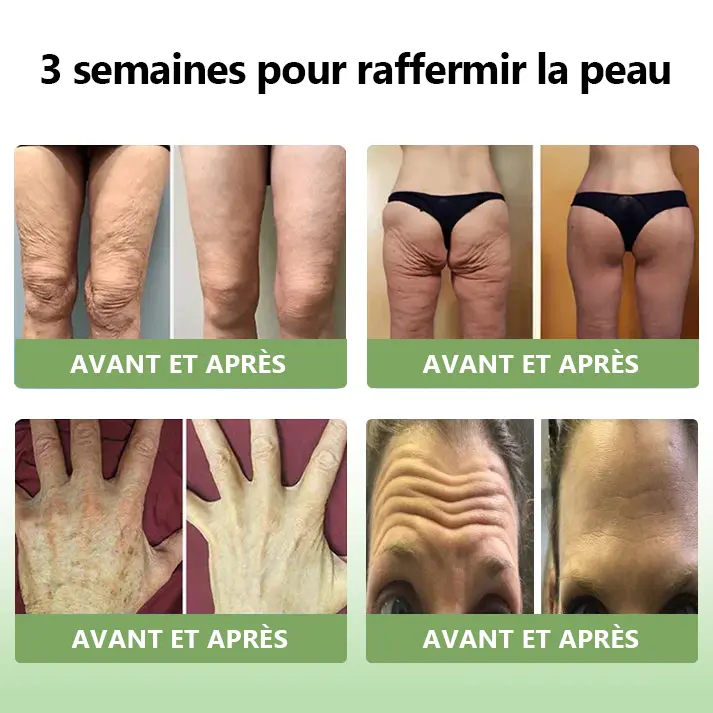 𝐂𝐫è𝐦𝐞 𝐑𝐚𝐟𝐟𝐞𝐫𝐦𝐢𝐬𝐬𝐚𝐧𝐭𝐞 𝐚𝐮 𝐂𝐨𝐥𝐥𝐚𝐠è𝐧𝐞 𝐝𝐞 𝐋𝐮𝐱𝐞 - Image 4