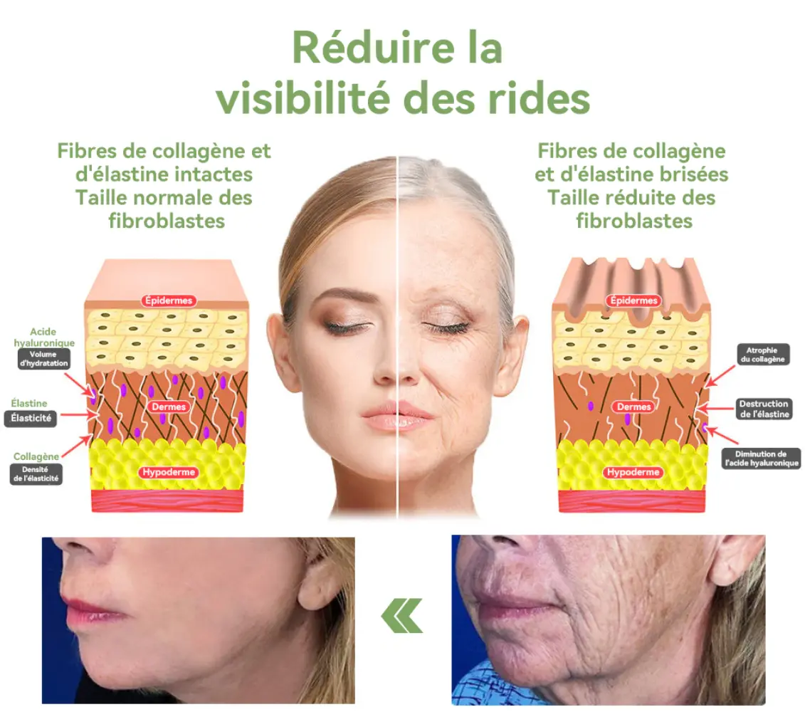 𝐂𝐫è𝐦𝐞 𝐑𝐚𝐟𝐟𝐞𝐫𝐦𝐢𝐬𝐬𝐚𝐧𝐭𝐞 𝐚𝐮 𝐂𝐨𝐥𝐥𝐚𝐠è𝐧𝐞 𝐝𝐞 𝐋𝐮𝐱𝐞 - Image 9