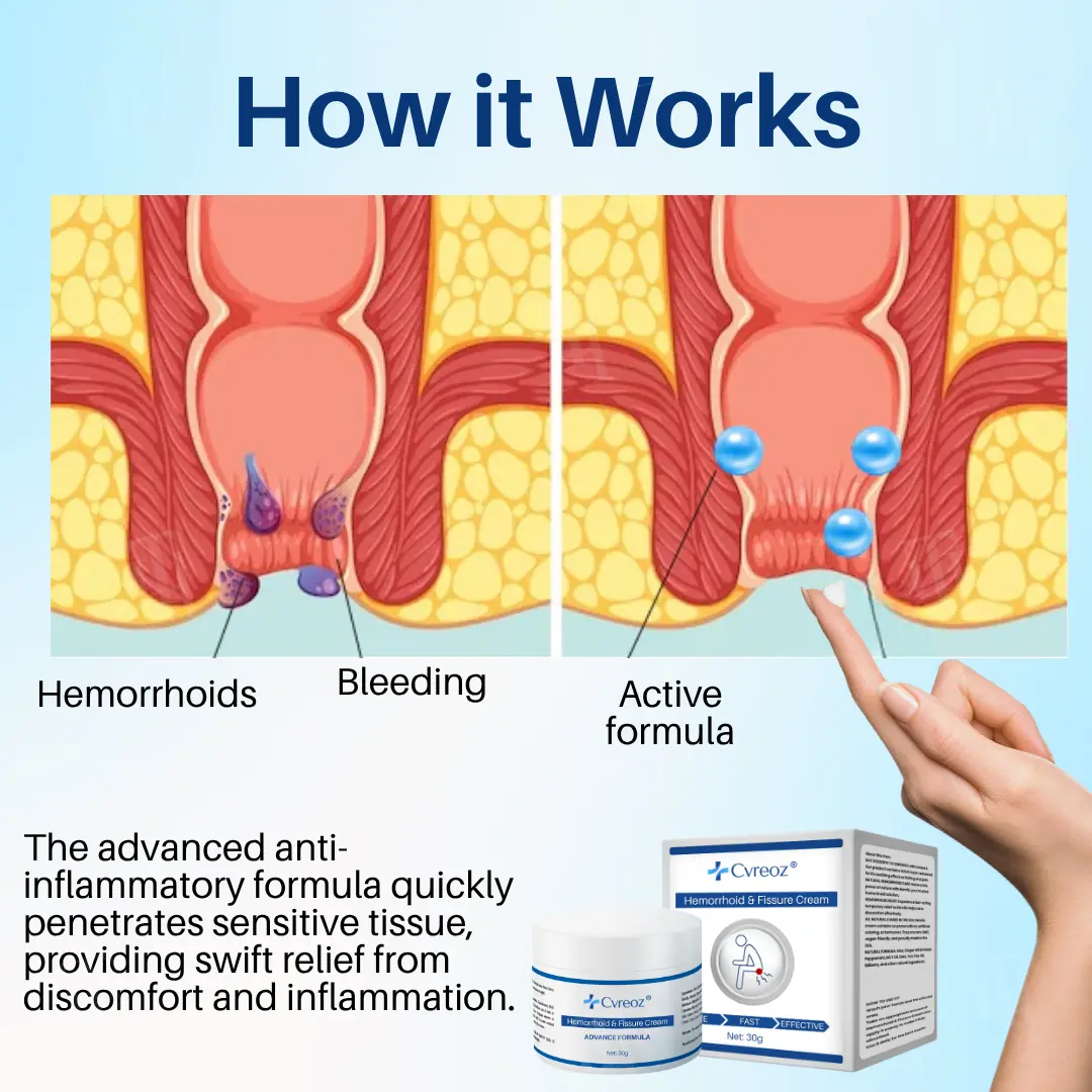 ๐๐ฒ๐บ๐ผ๐ฟ๐ฟ๐ต๐ผ๐ถ๐ฑ & ๐๐ถ๐๐๐๐ฟ๐ฒ ๐๐ฟ๐ฒ๐ฎ๐บ - Image 5