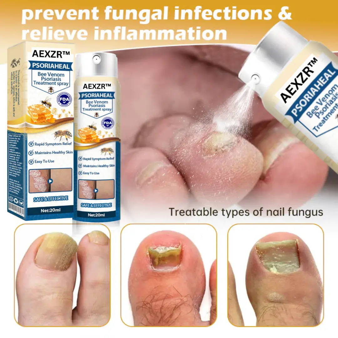 PsoriaHeal Bee Venom Psoriasis Treatment Spray - Image 6