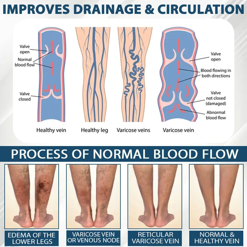 Black Cumin Edema Detox Herbal Cream - Image 7