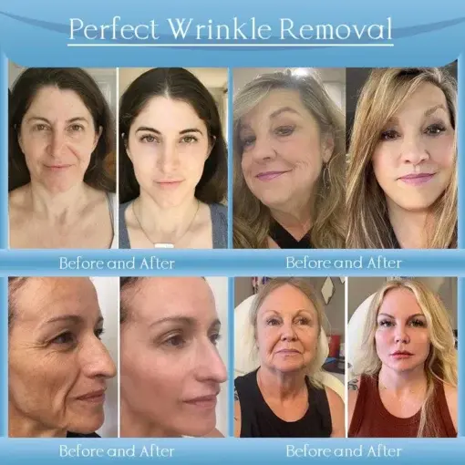 Age-Defying Lifting Serum - Image 3