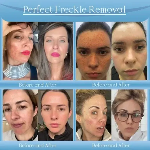 Age-Defying Lifting Serum - Image 4
