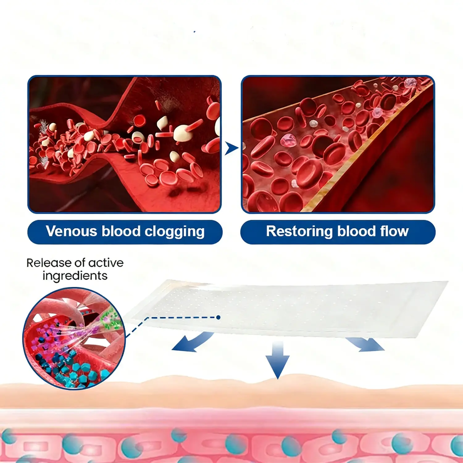 Vein Contour Micro-Patches: The 7-Day Transformation for Varicose Veins - Image 10