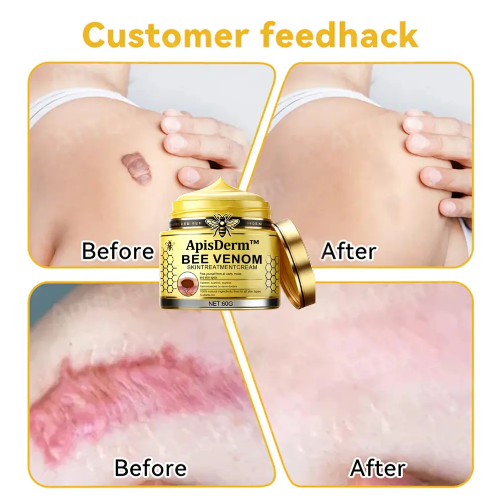 Bee Venom Skin Treatment Cream - Image 10
