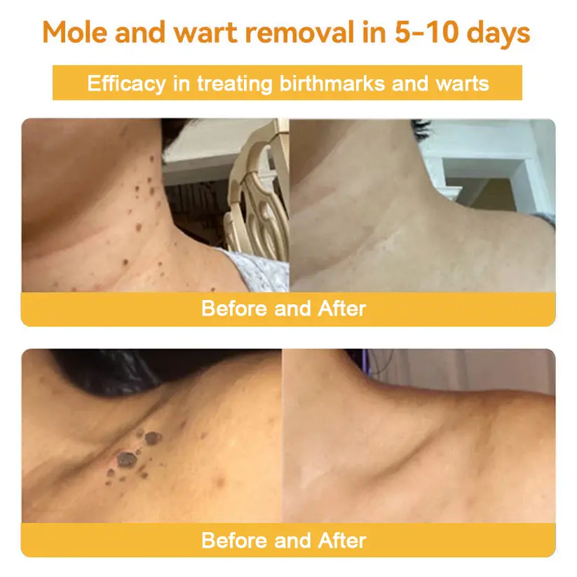 Bee Venom Skin Treatment Cream - Image 5