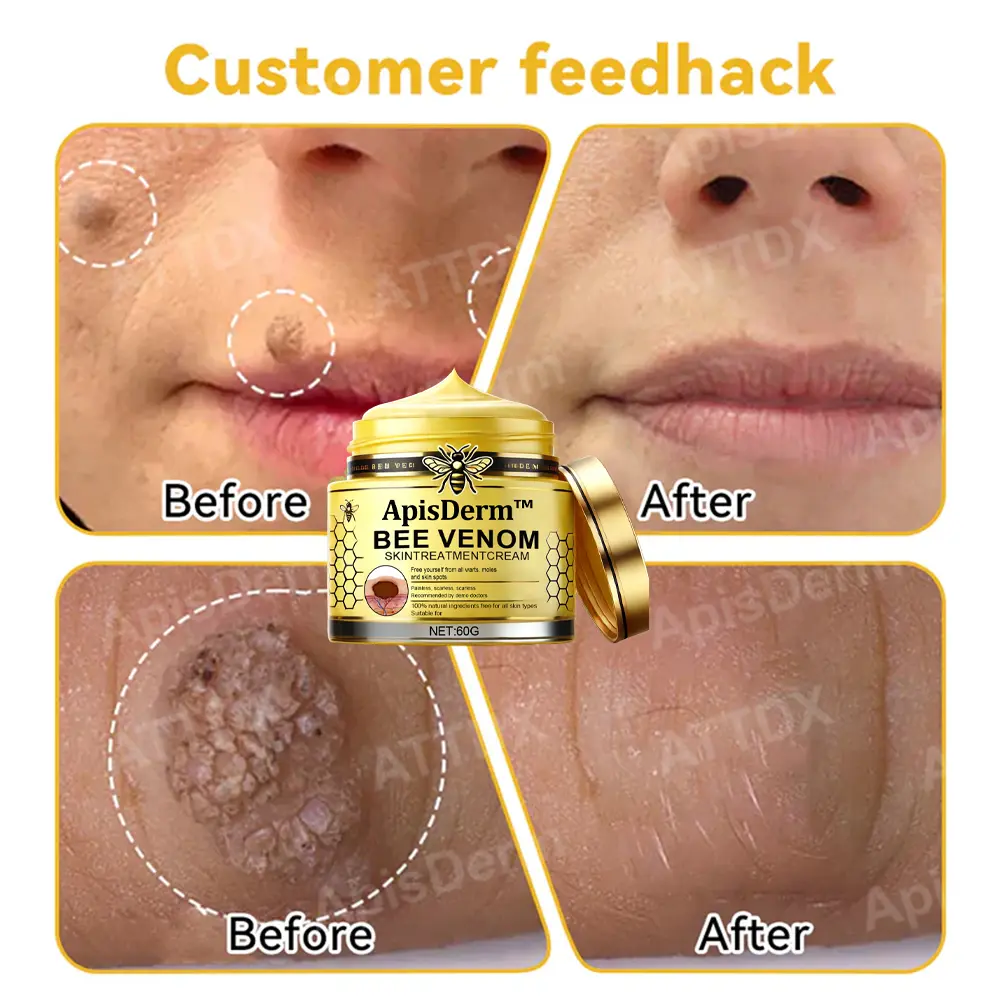 Bee Venom Skin Treatment Cream - Image 6