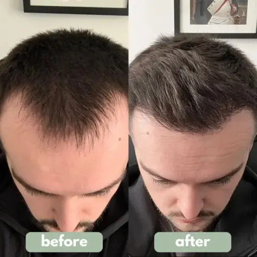 Hair Growth Serum - Image 2
