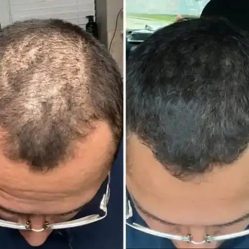 Hair Growth Serum - Image 5