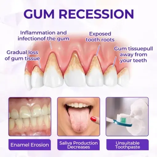 SensiGum Fluoride Toothpaste - Image 8