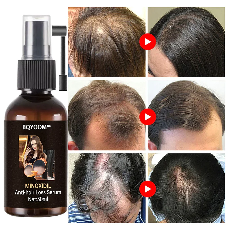 Rapid Hair Regrowth Oil - Image 6
