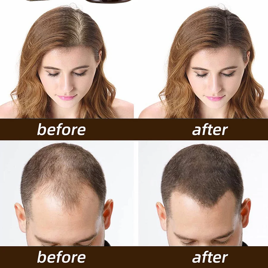 Rapid Hair Regrowth Oil - Image 2